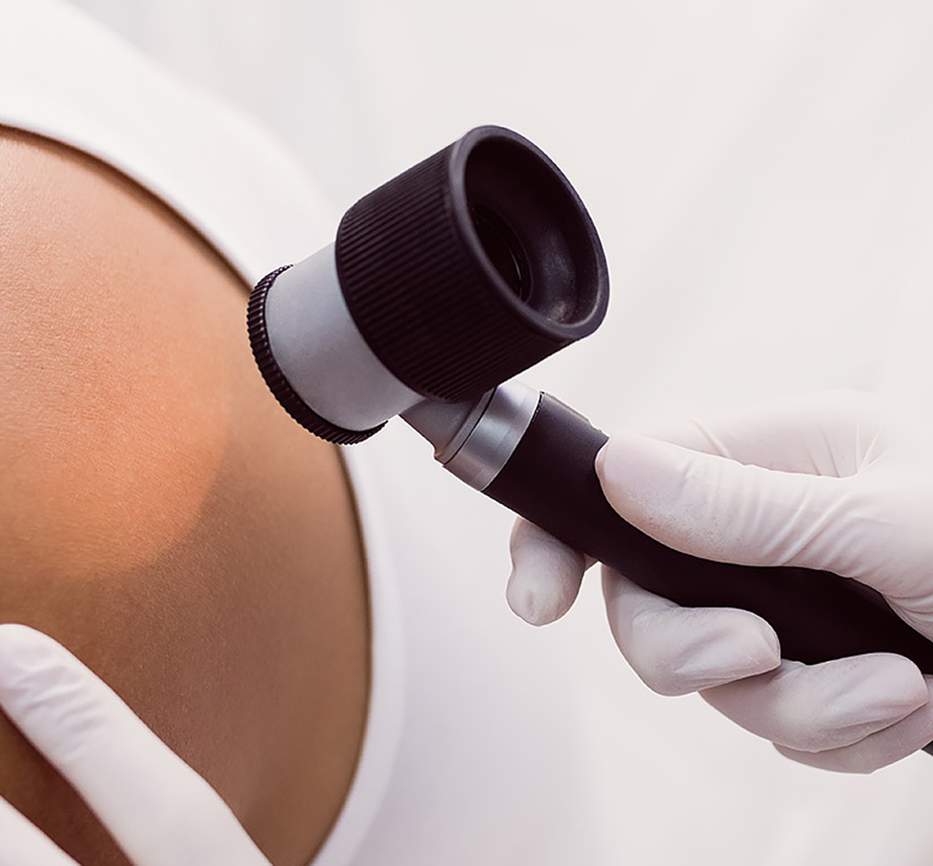 Gloved professional assessing a volunteer's shoulder skin with a dermatoscope