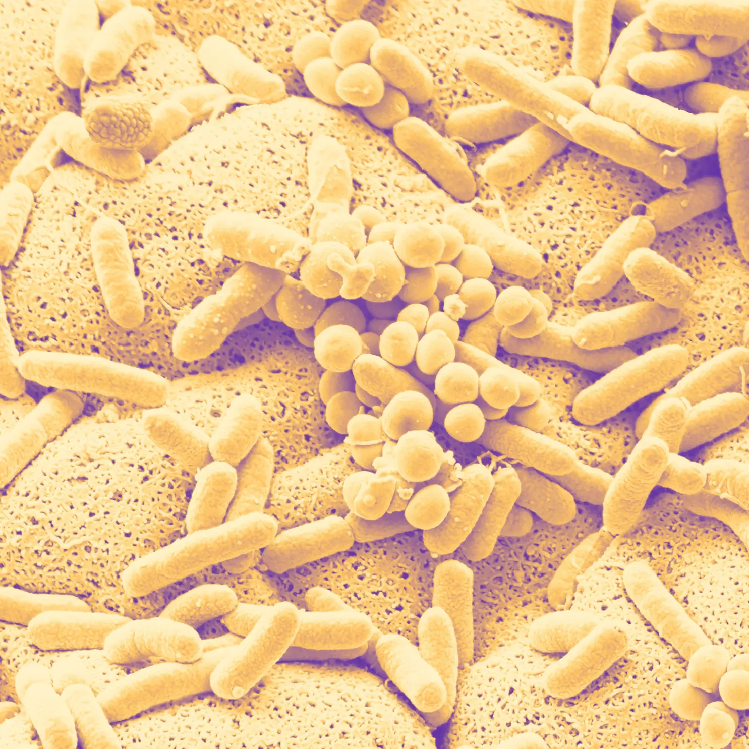 Duotone yellow SEM photograph of a microbial community